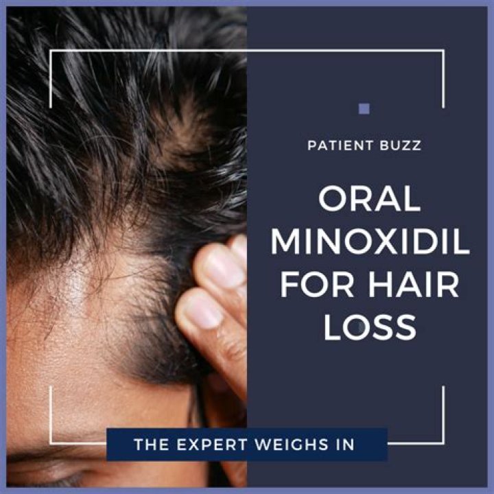 What does minoxidil do to healthy hair?