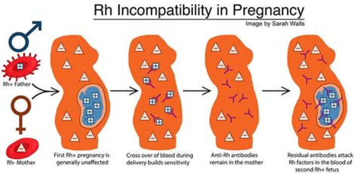 What does RH modern stand for?
