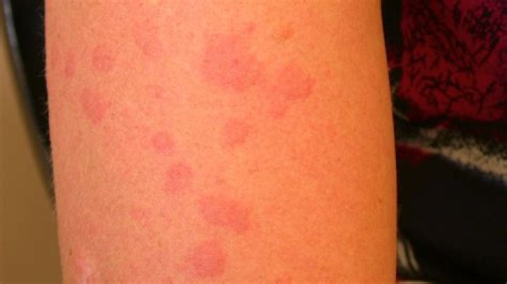 What does Sun fungus look like?