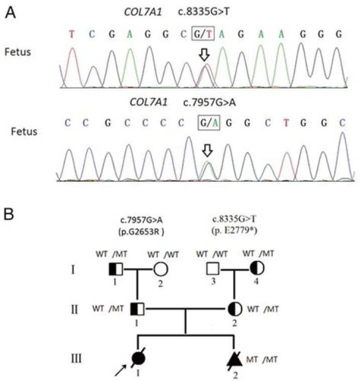 What does the COL7A1 gene do?