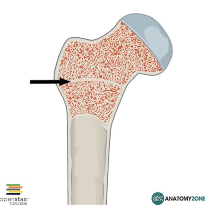What does the epiphyseal line indicate?