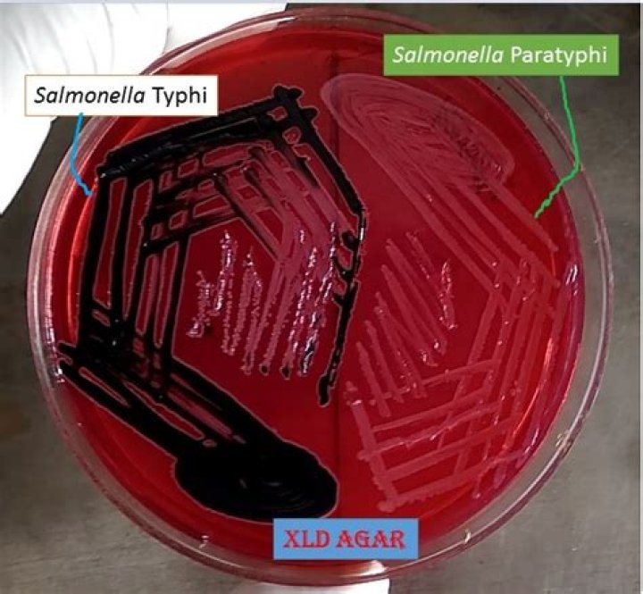 What does XLD Agar test for?