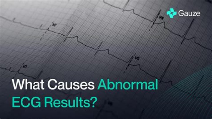 What happens if echocardiogram is abnormal?