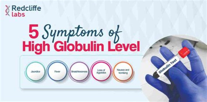 What happens if serum globulin is high?