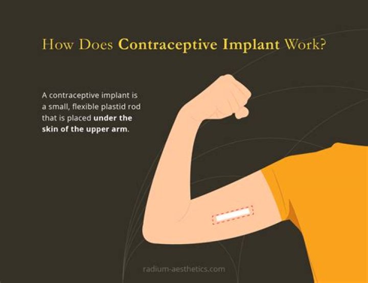 What happens if the implant breaks in your arm?