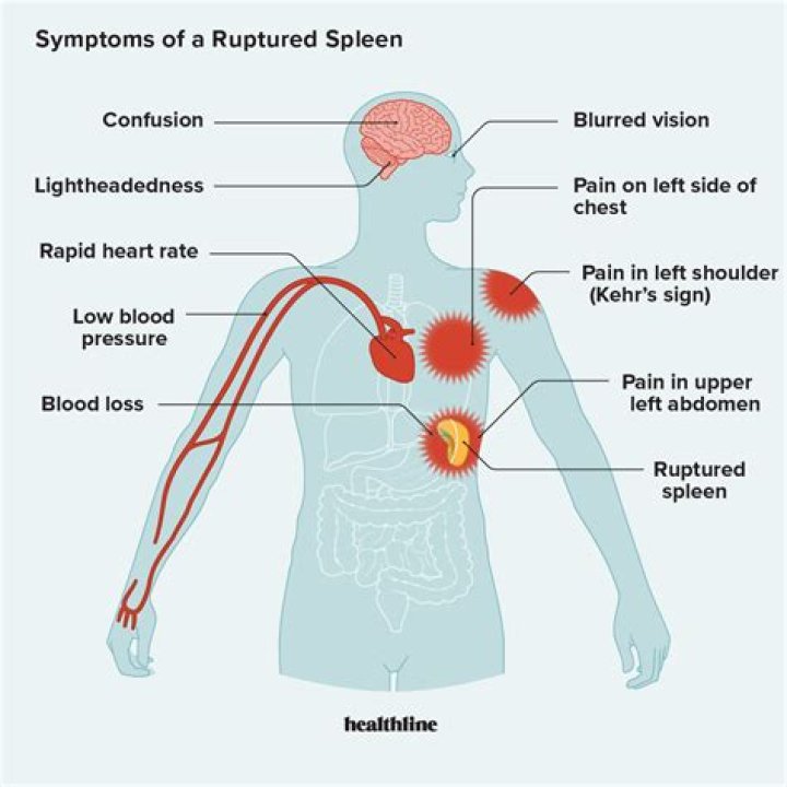 What happens if the spleen is injured?