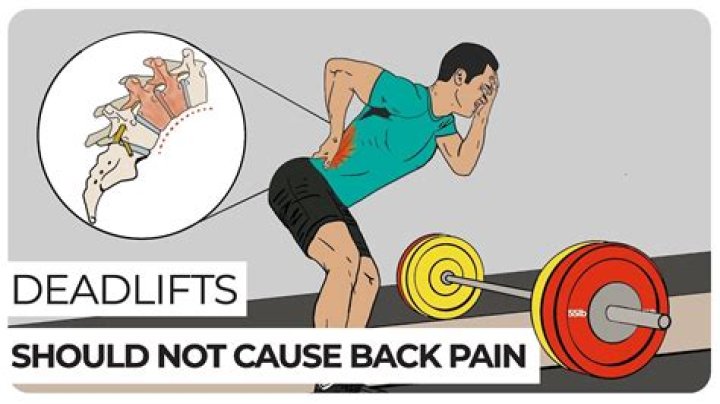 What injuries can deadlifts cause?