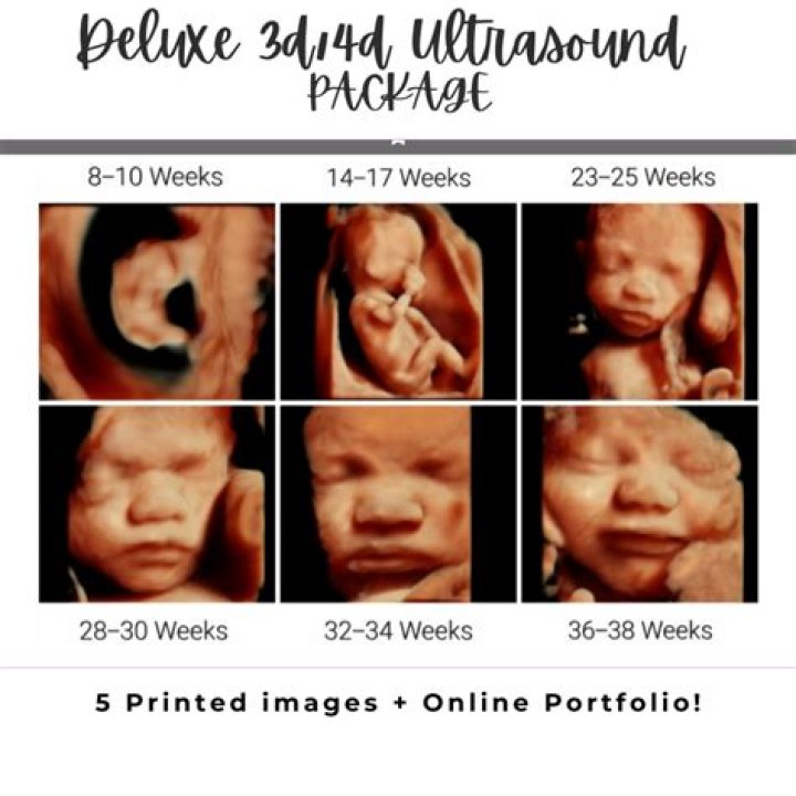 What is a 3D/4D ultrasound?