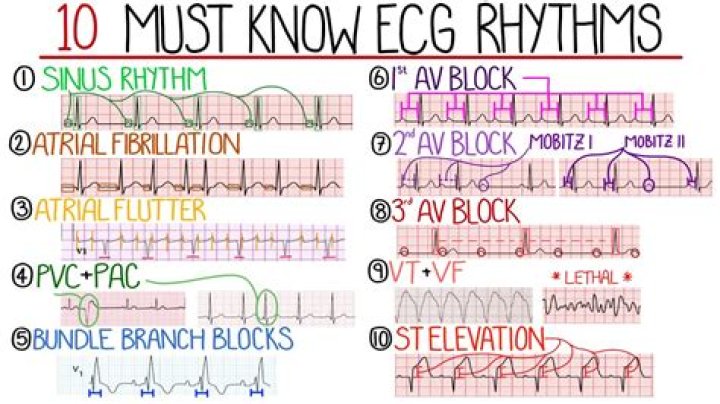 What is a 7 8 rhythm?