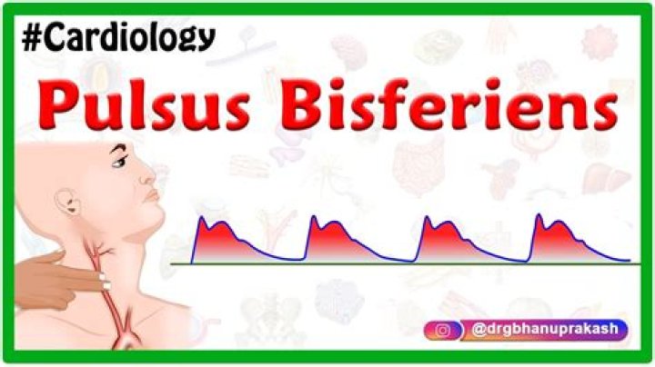 What is a Bisferiens pulse?