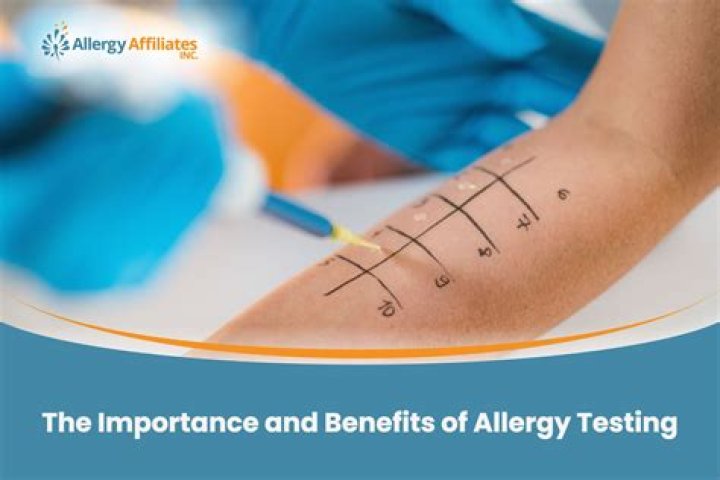 What is a high number for allergy testing?