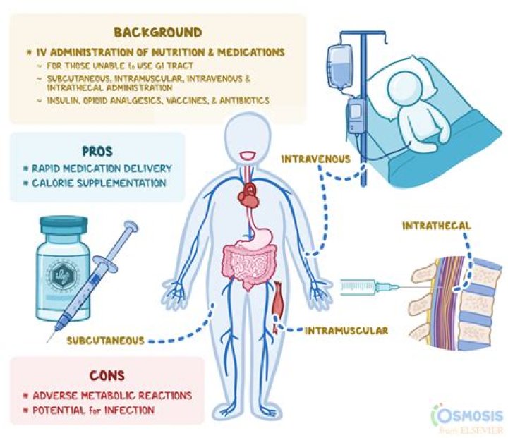 What is a parenteral medication?