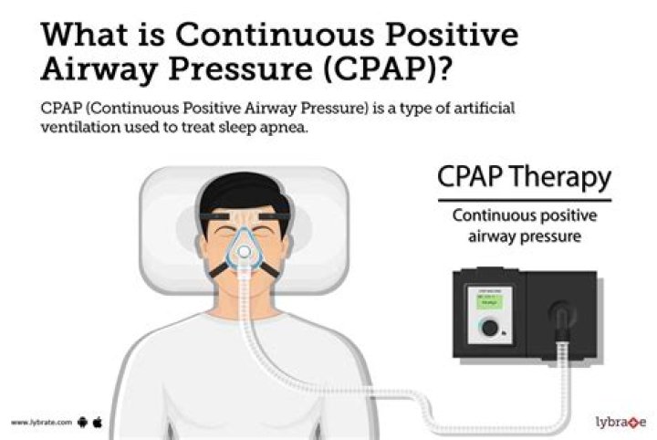 What is a positive pressure cap?