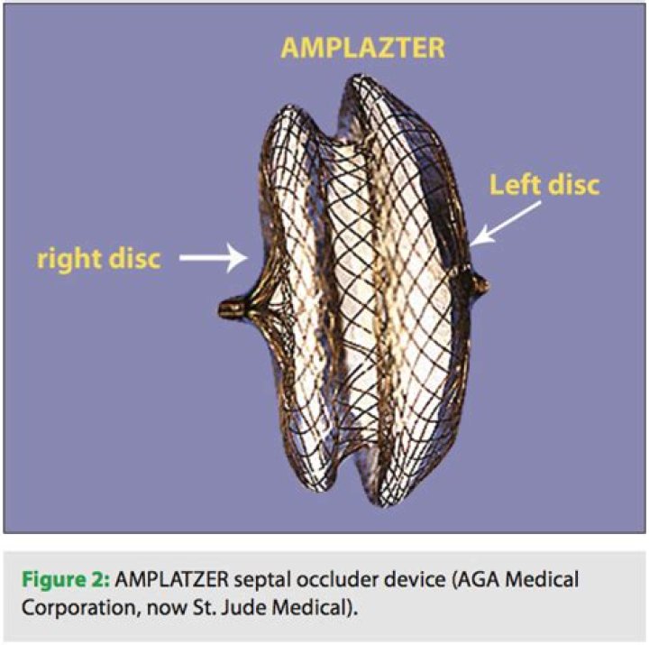 What is a septal occluder?
