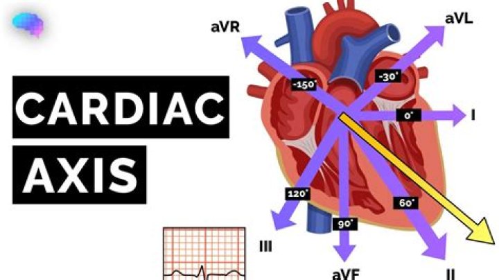 What is an axis 2 diagnosis?