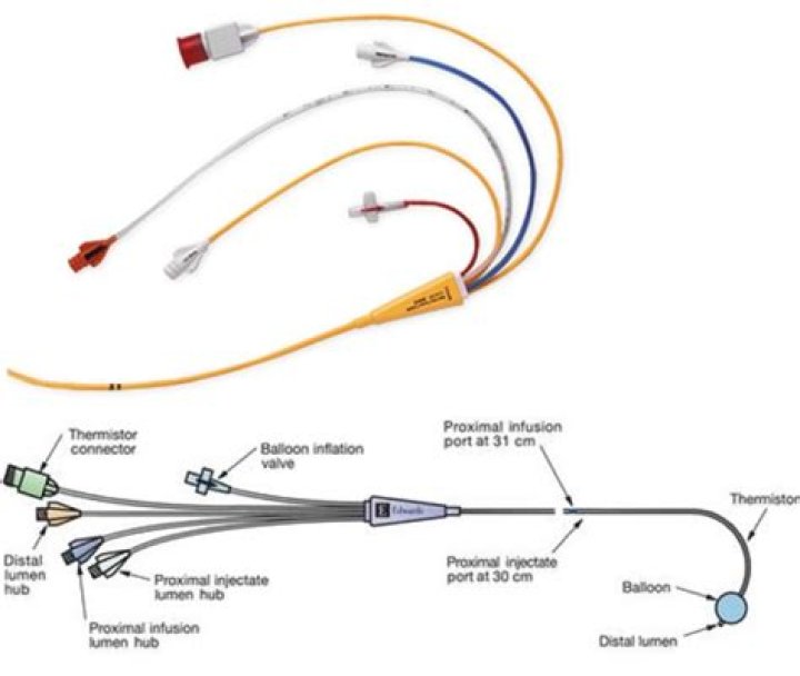 What is an Rij catheter?