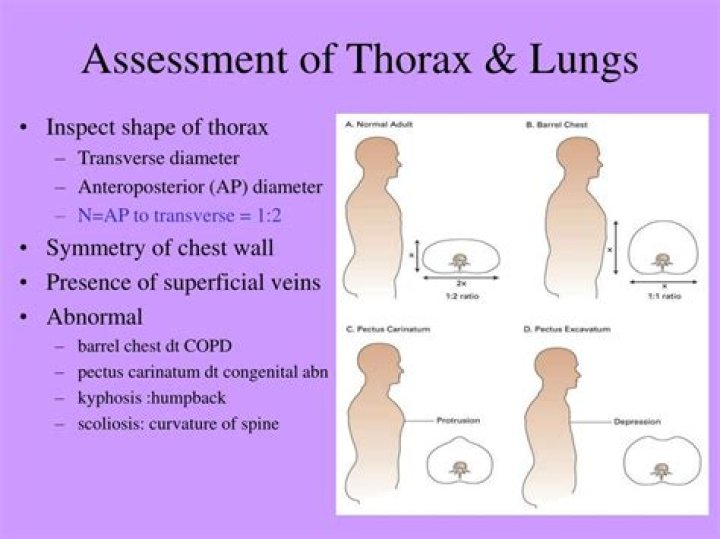 What is anteroposterior diameter?