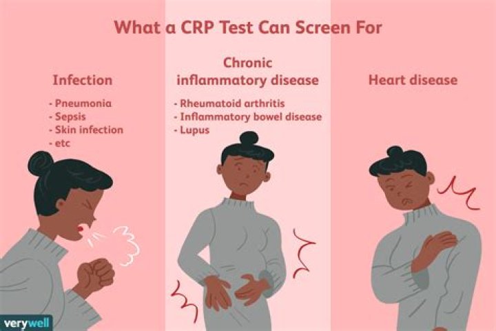 What is C in CRP test?