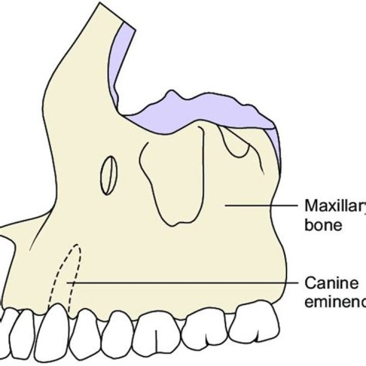 What is canine eminence?