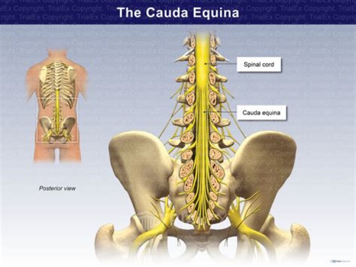 What is cauda equina definition?