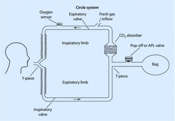 What is closed circuit anesthesia?