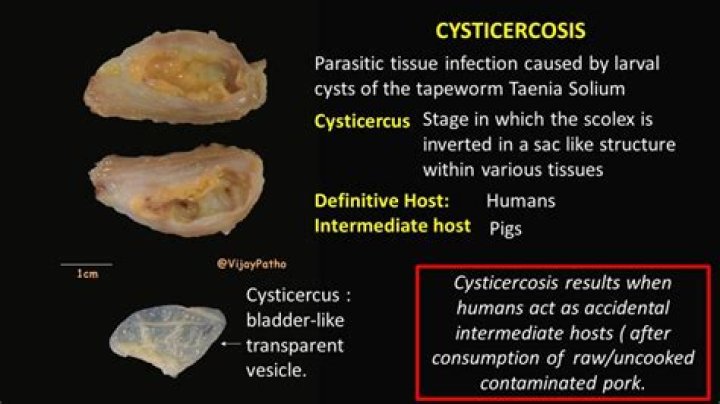 What is cysticercus larva?