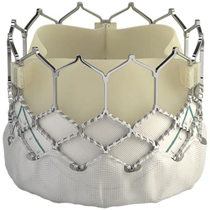 What is Edwards Sapien valve?