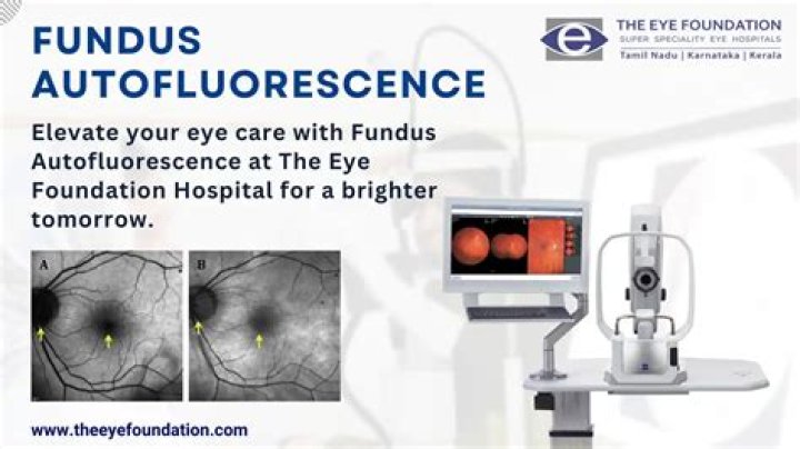 What is fundus autofluorescence test?