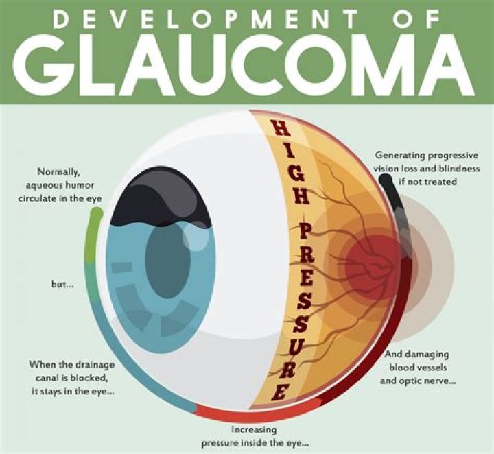 What is glaucoma and how is it treated?