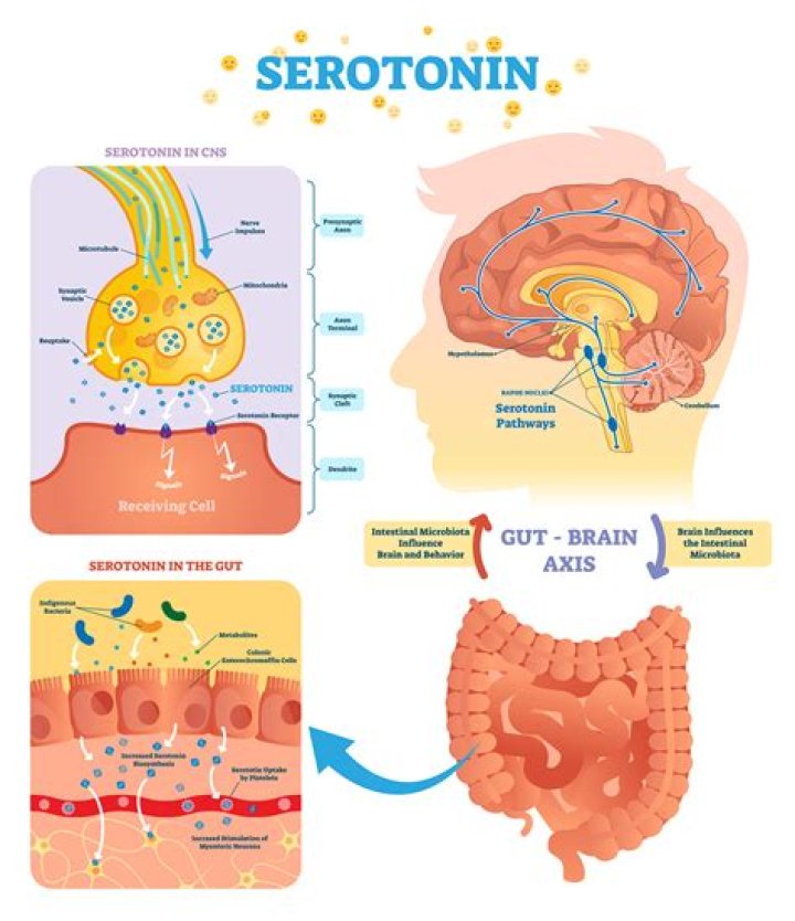 What is Hyperserotonemia?