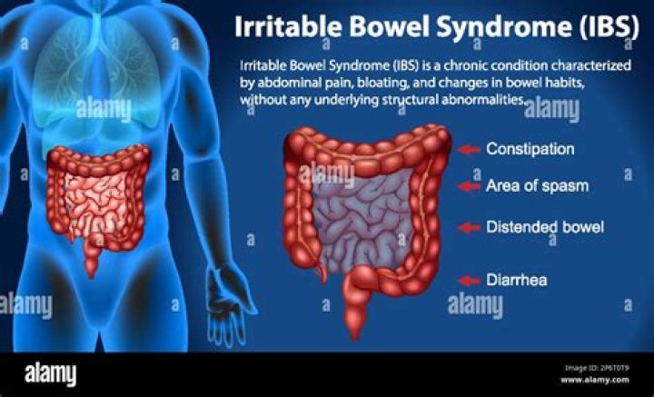 What is irritable bowel syndrome with constipation (IBS-C)?