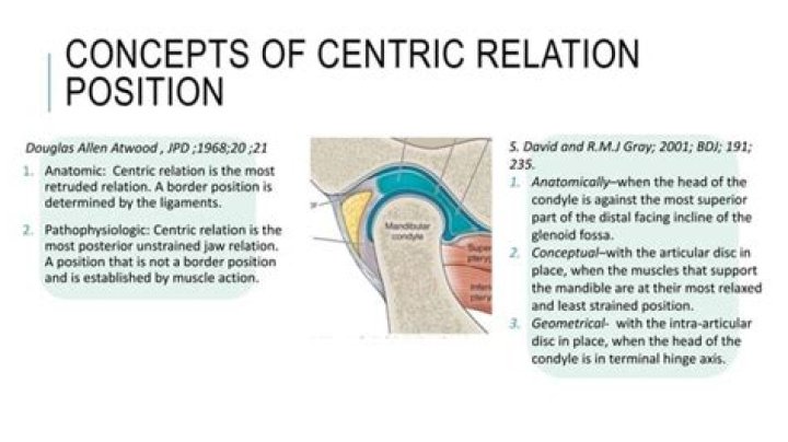 What is meant by centric relation?