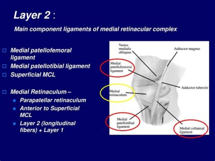 What is medial Retinacular plication?