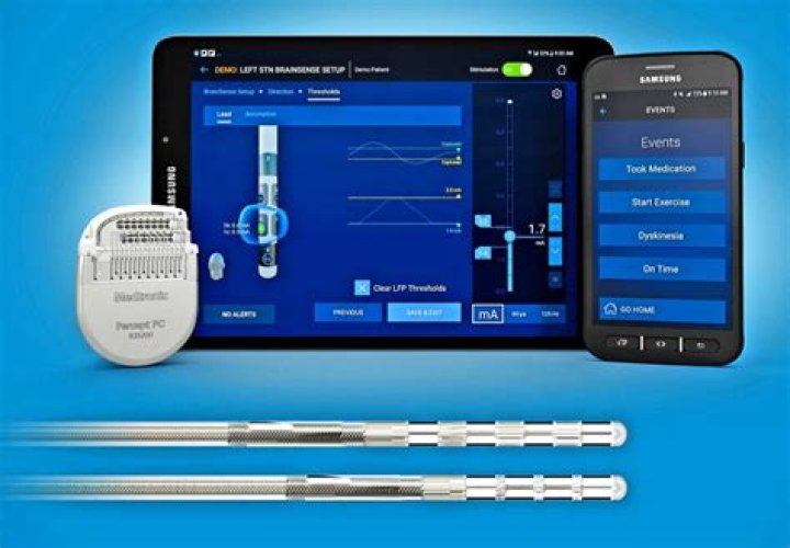 What is Medtronic DBS?