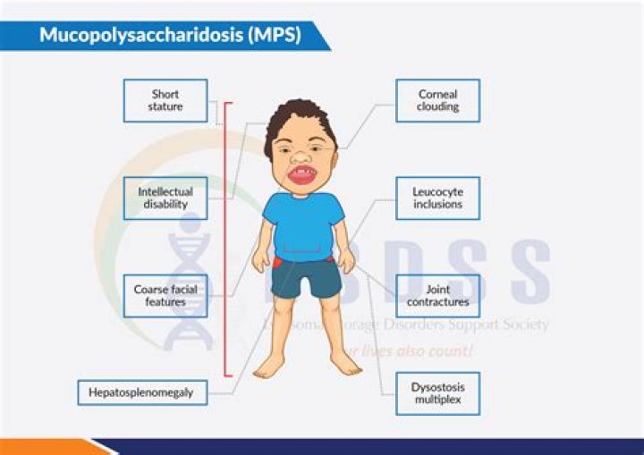 What is mucopolysaccharidosis type 1?