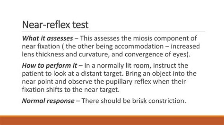 What is near reflex test?