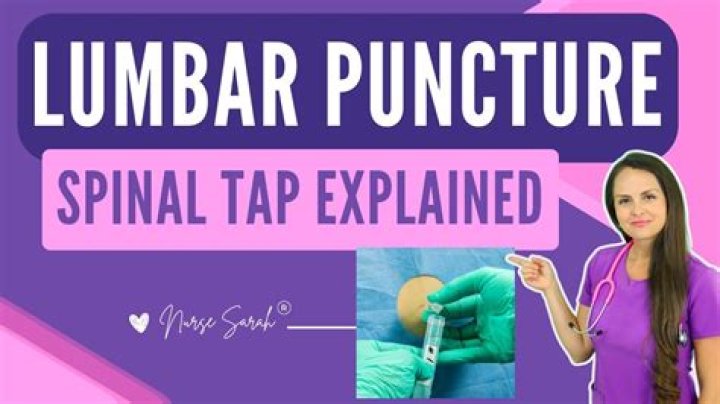 What is normal opening pressure for Spinal Tap?