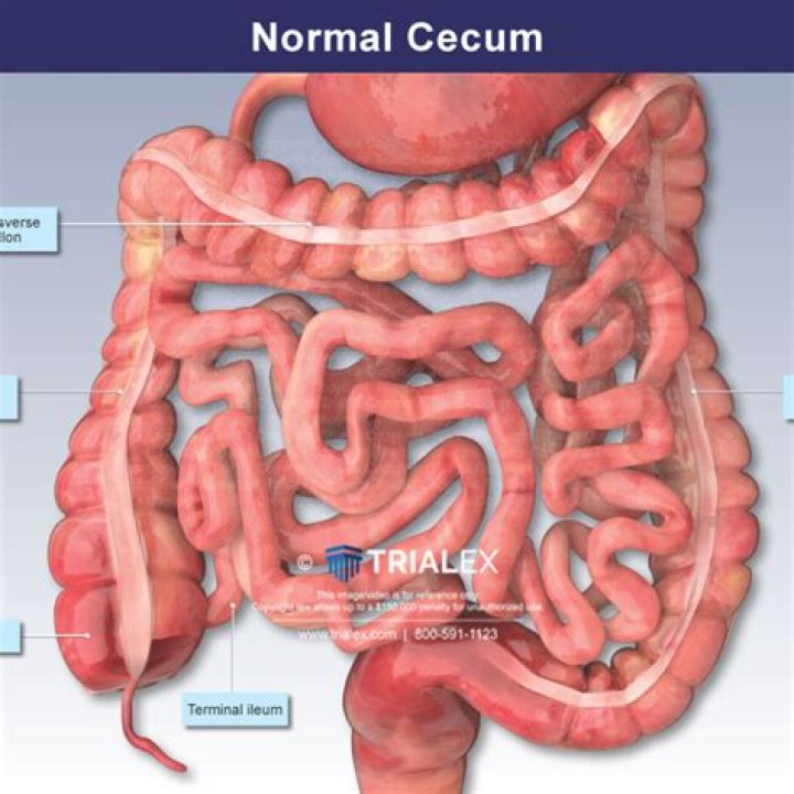 What is normal terminal ileum?