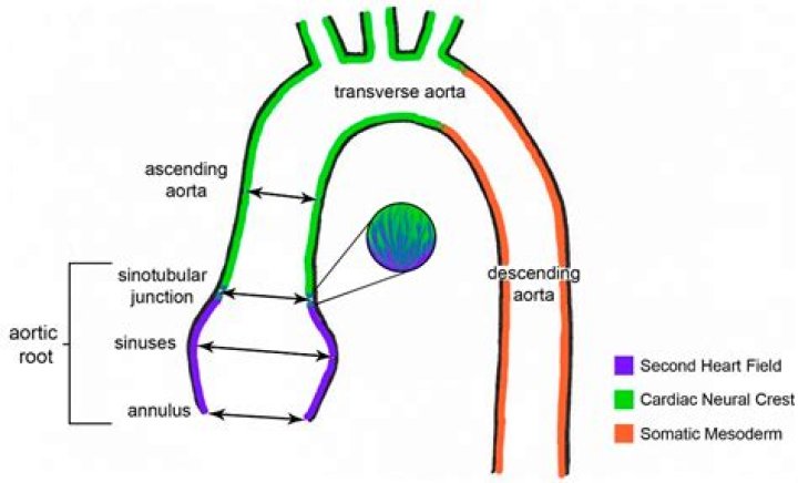 What is Sinotubular Junction?
