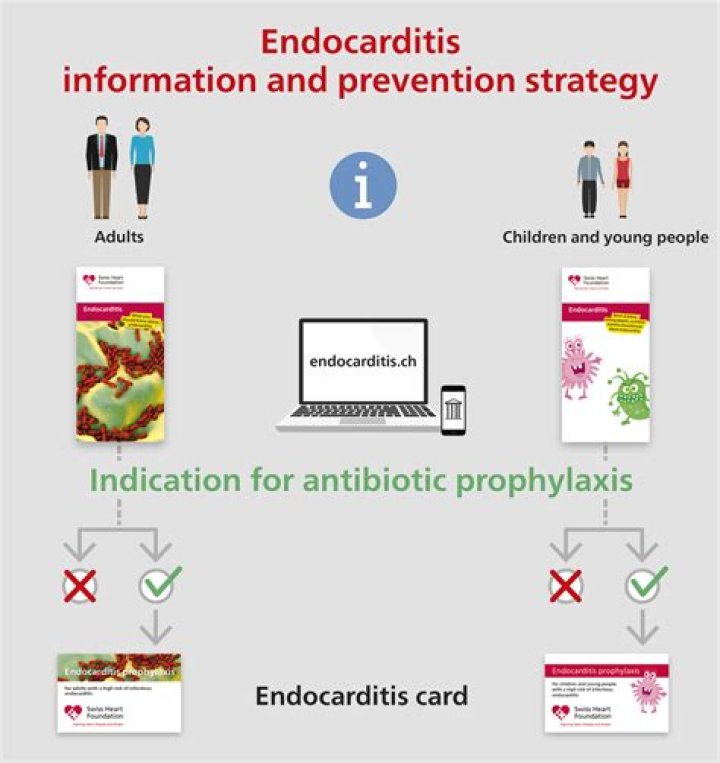What is the antibiotic of choice for prophylaxis against infective endocarditis?