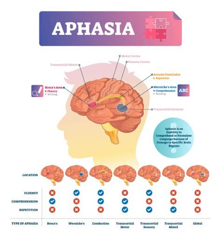 What is the CETI aphasia?