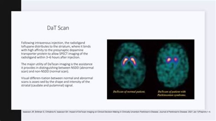 What is the difference between a DaTscan and a Spect scan?