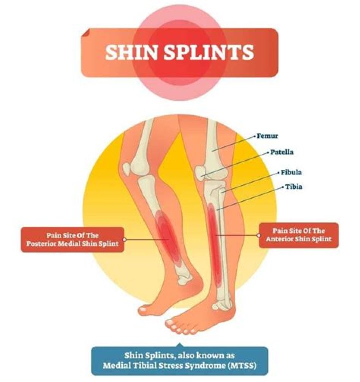 What is the fastest way to heal anterior shin splints?