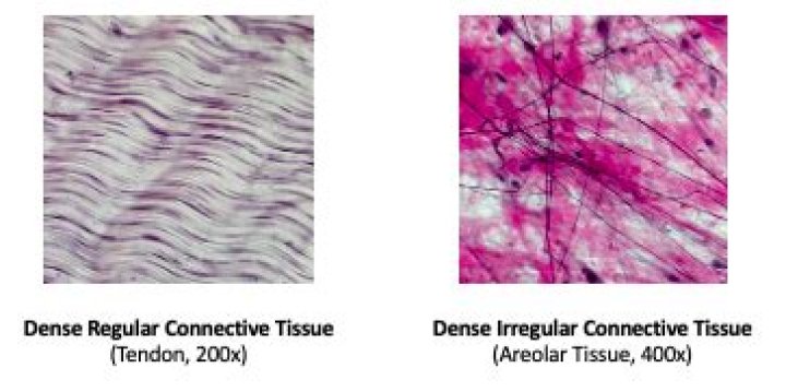 What is the general function of dense regular and dense irregular connective tissue?