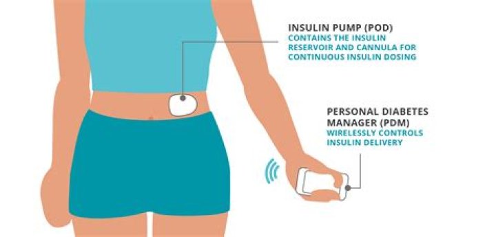 What is the highest rated insulin pump?