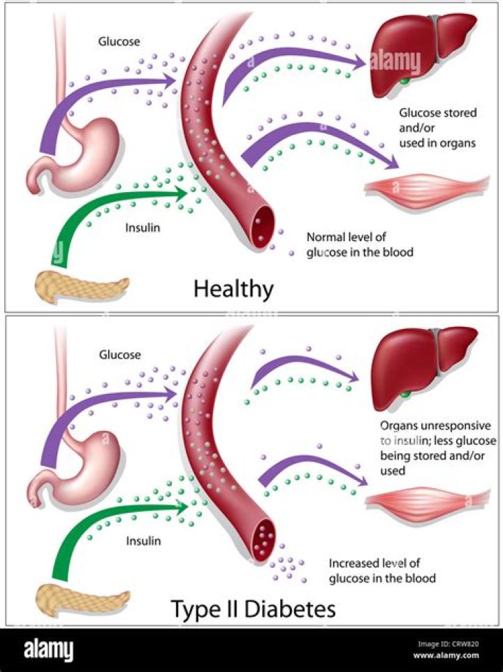 What is the mechanism of diabetes mellitus?