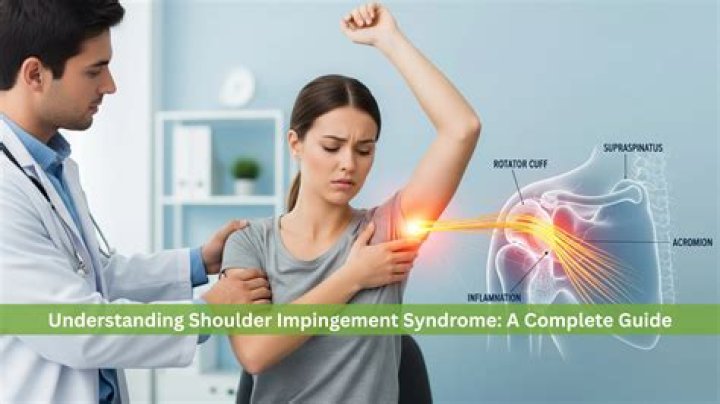 What is the medical definition for impingement syndrome?