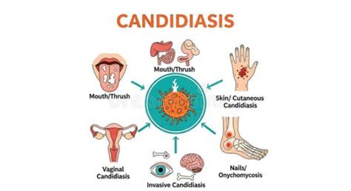 What is the mode of transmission for candidiasis?