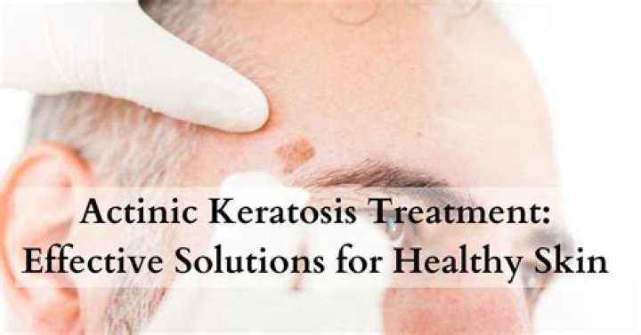 What is the most effective treatment for actinic keratosis?