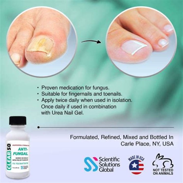 What is the most effective treatment for toenail fungus UK?